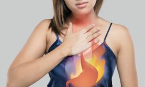 Holistic Acid Reflux Treatment